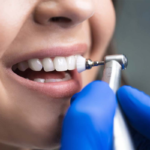 Benefits of Enamel Dentistry