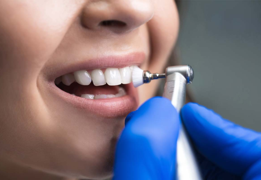 Benefits of Enamel Dentistry